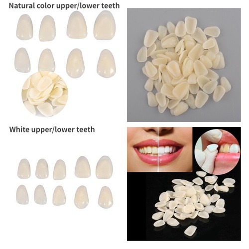 5sacchetti faccette corona - faccette,